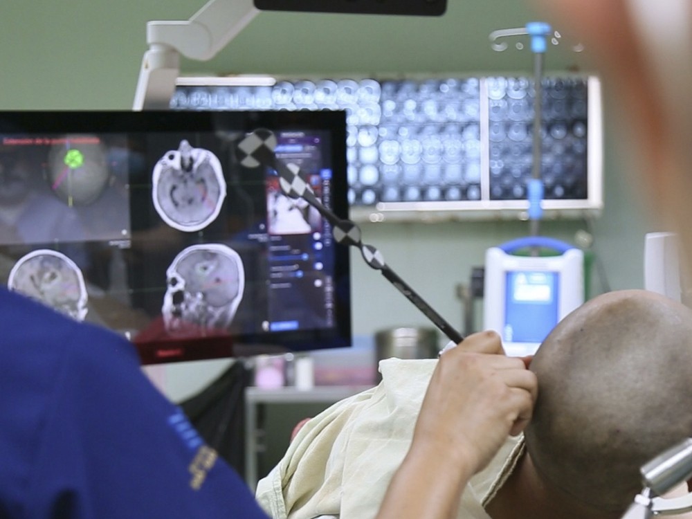 HRO utiliza equipo de última generación  para tratar tumor cerebral  