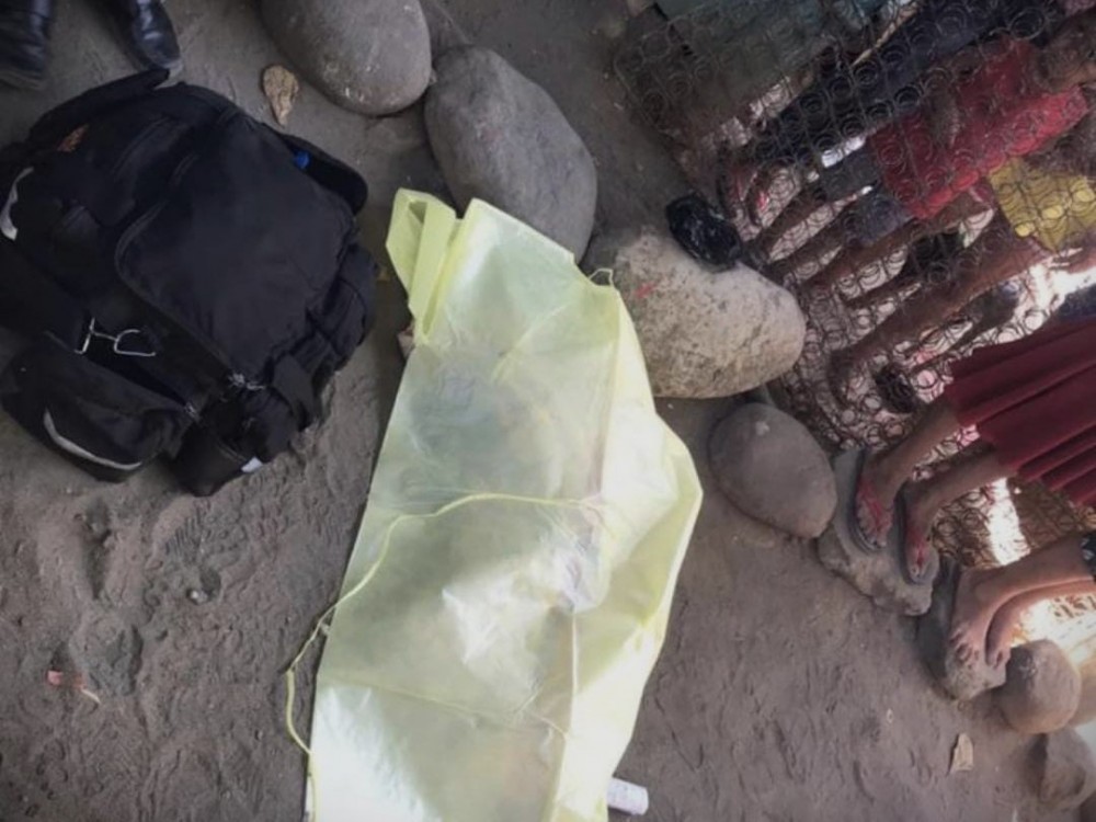 Muere niño de dos años que fue atropellado en Pajapita