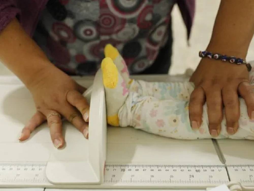 En municipios priorizados se reduce en 28 por ciento casos acumulados de desnutrición aguda