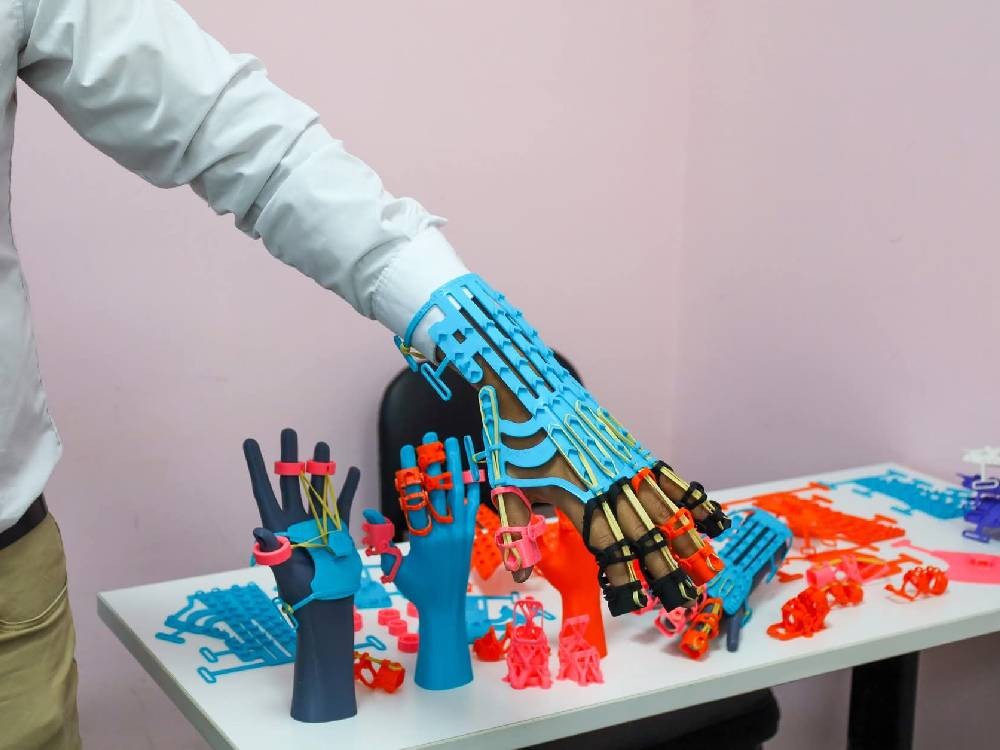 Estudiante presenta exosqueleto de rehabilitación terapéutica impreso en 3D