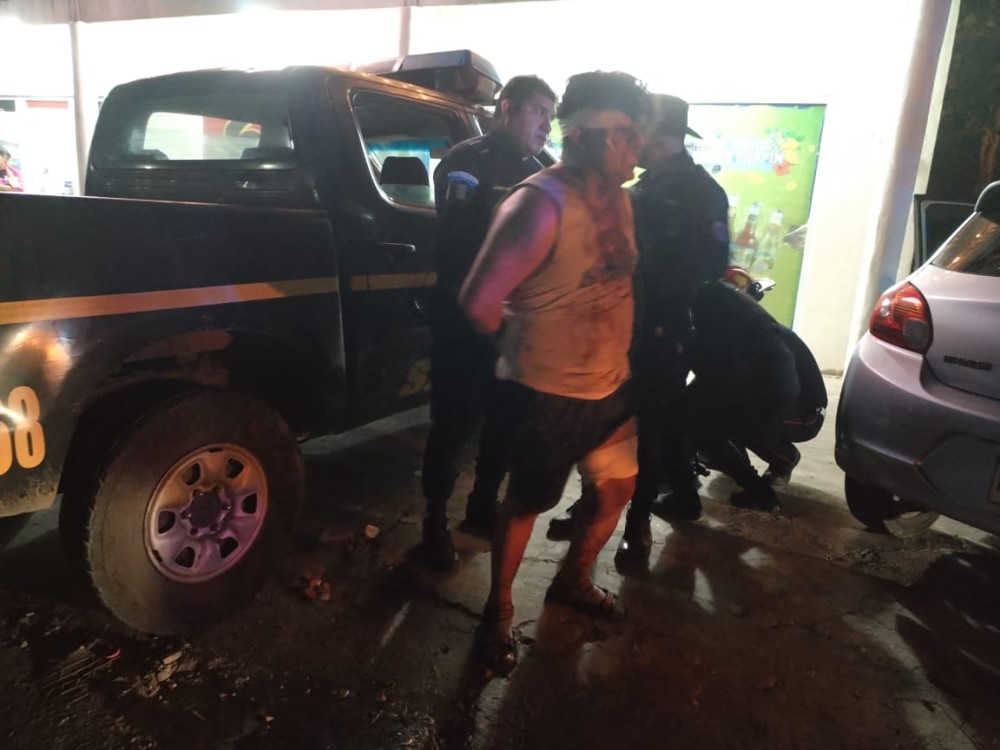 Hombre de 30 años se dispara accidentalmente en San Marcos 