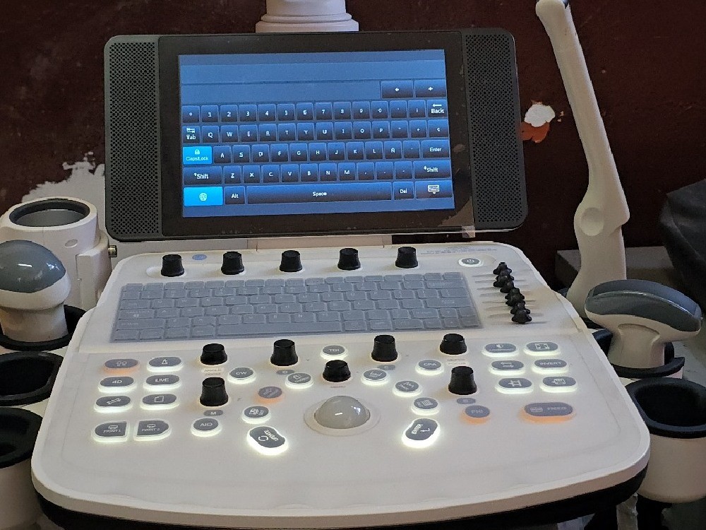Hospital de Mazatenango adquiere nuevo servicio de Ultrasonido 4D