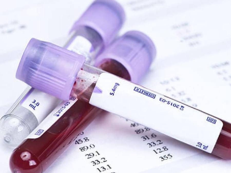 La revolución de la biopsia líquida: cómo los análisis de sangre detectan el cáncer años antes de los primeros síntomas