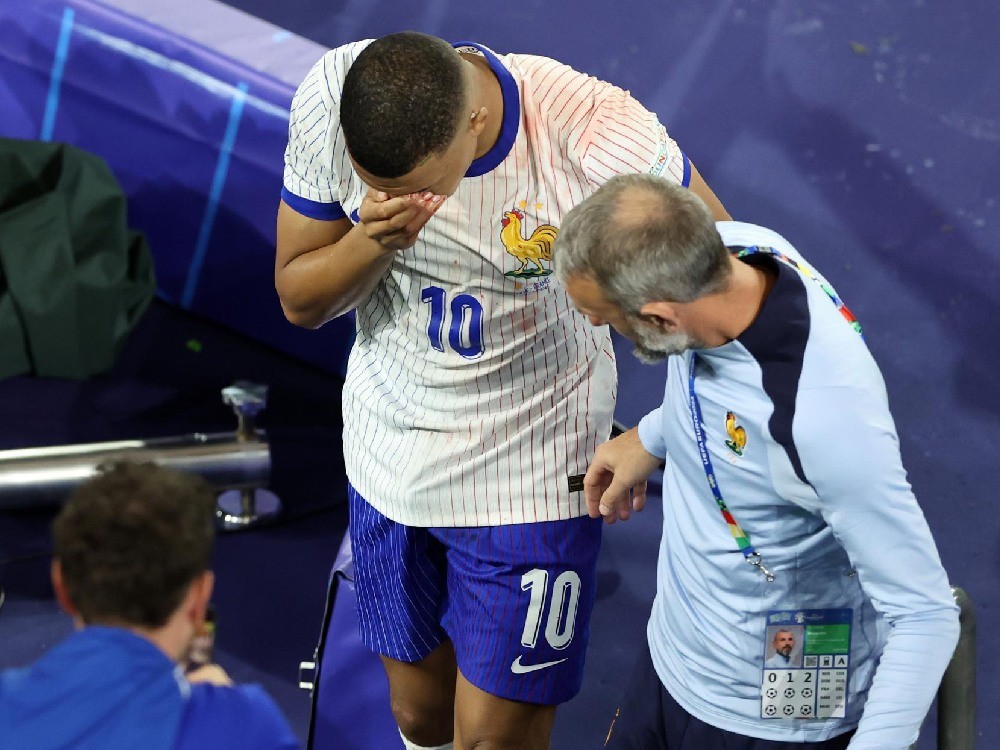 Mbappé sufre fractura de nariz y será operado