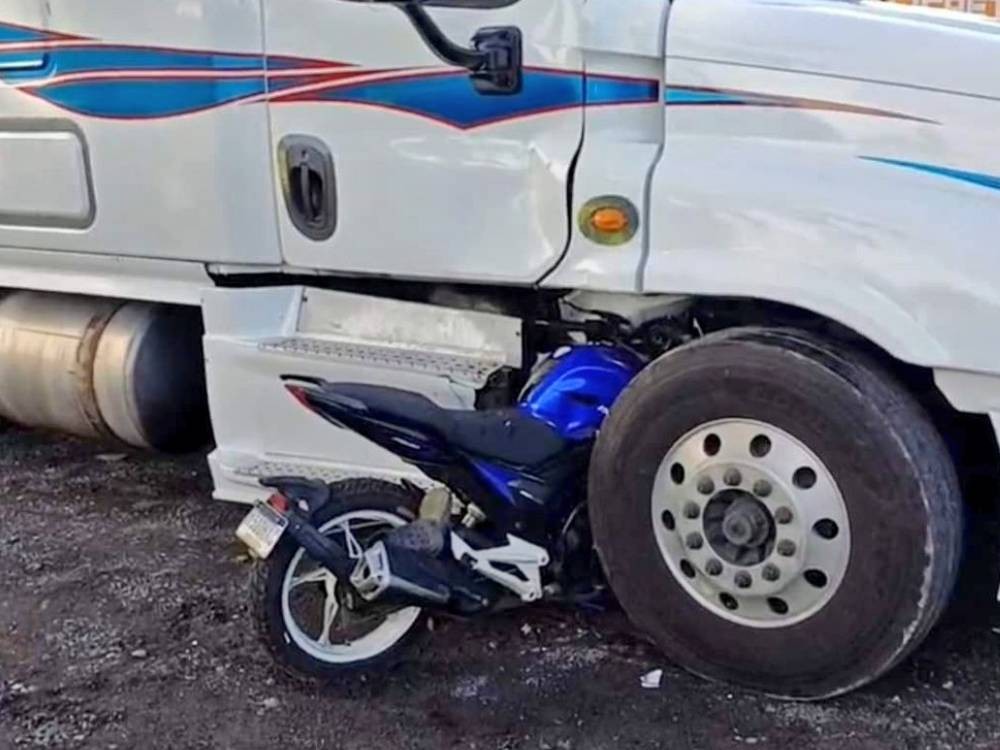 VIDEO: motociclista pierde una pierna tras brutal accidente en Coatepeque
