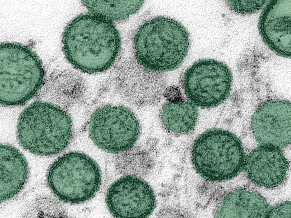Salud confirma que no hay riesgo de hantavirus en Guatemala