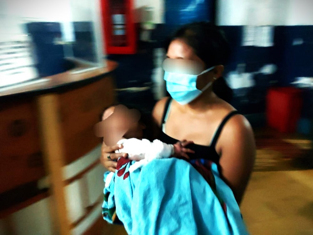 Niña de dos años sufre quemaduras al introducir su mano en una olla de nixtamal