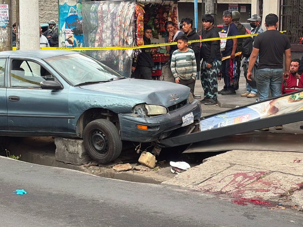 Paciente continúa recuperación tras sufrir amputación de miembro inferior en accidente de tránsito en Quetzaltenango