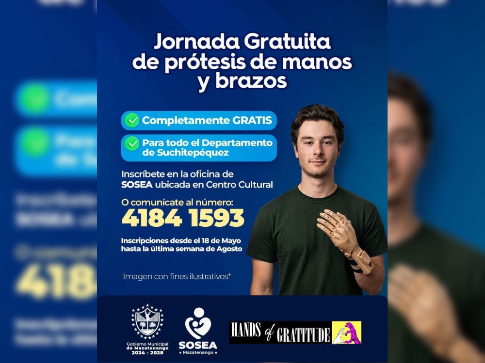 SOSEA Mazatenango anuncia jornada de donación de prótesis gratuitas de mano y brazo