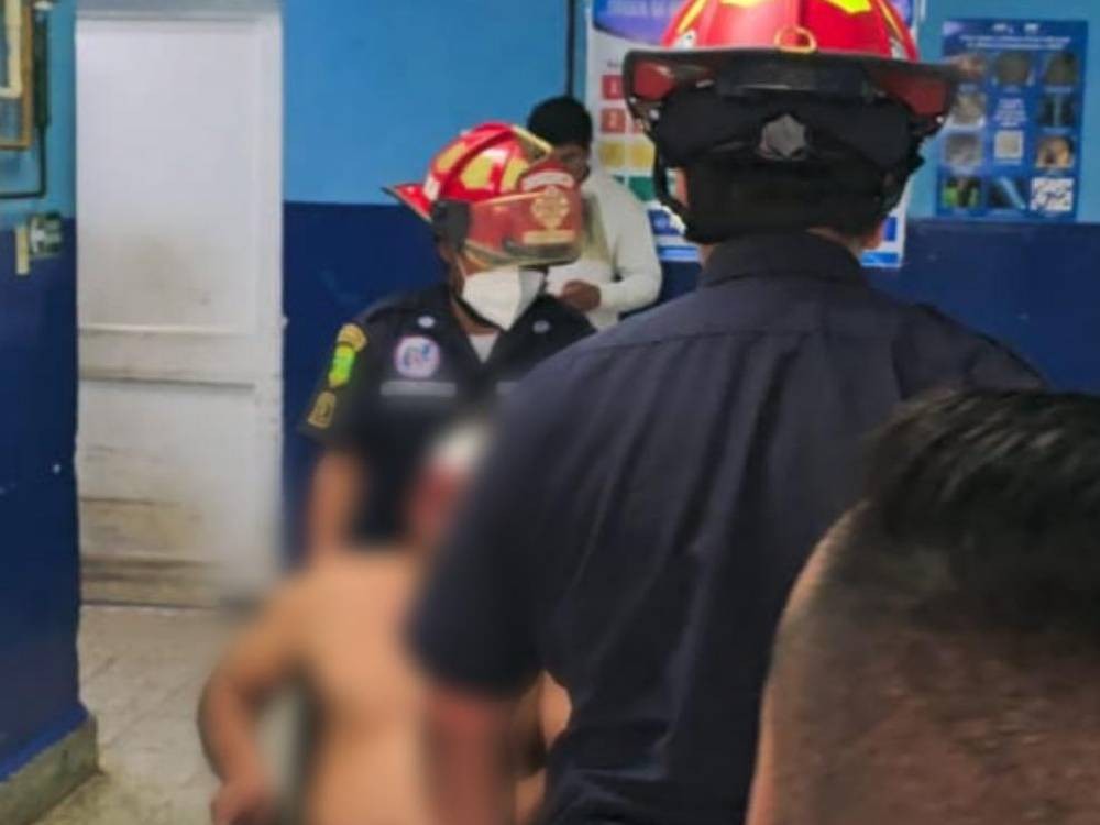 Un hombre sufre quemaduras de segundo grado por pirotecnia 